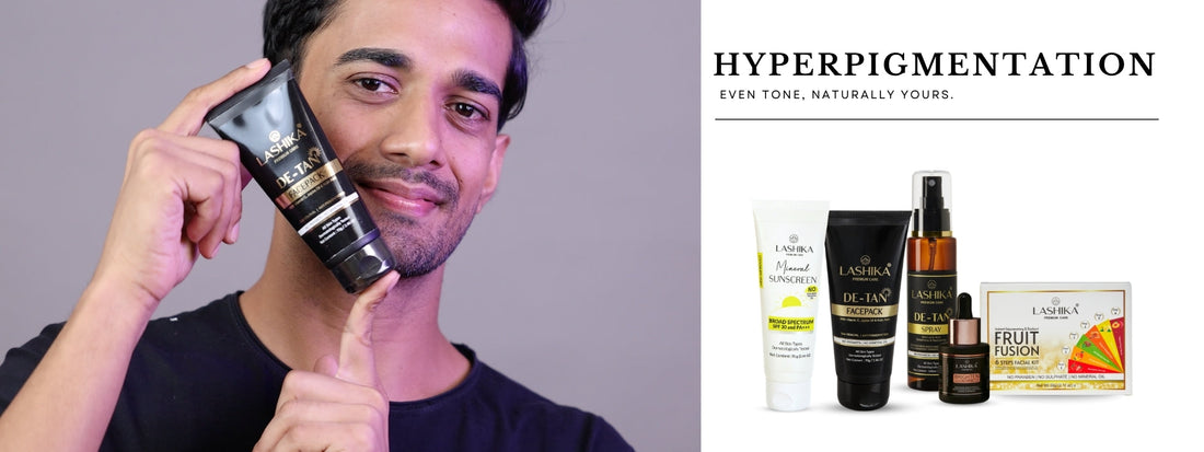 Hyperpigmentation