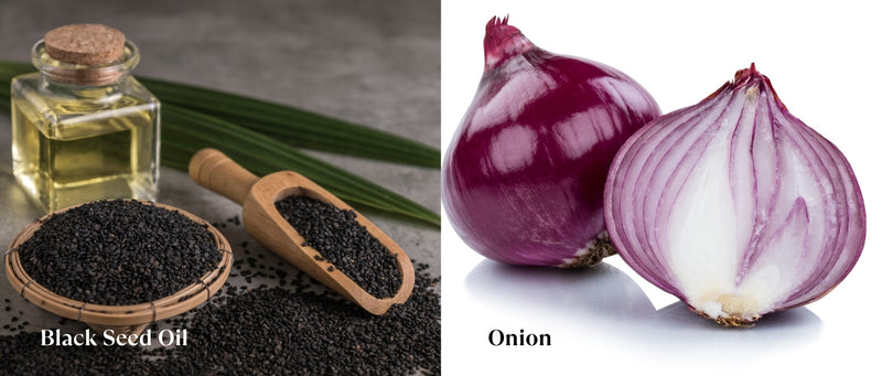 Lashika Onyn Hair Oil with Black Seed Oil & Onion – Strengthens hair, reduces hair fall, nourishes the scalp & promotes healthy growth.